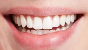 How Long Can You Keep Your Teeth With Periodontal Disease